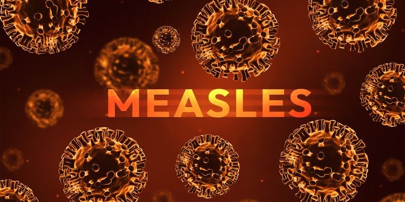 Measles in 2026: Symptoms, How It Spreads, Vaccine Facts, and the Latest US Outbreak Data